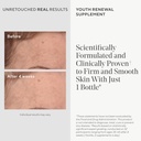 murad-youth-renewal-supplement-for-smoot-3.jpg