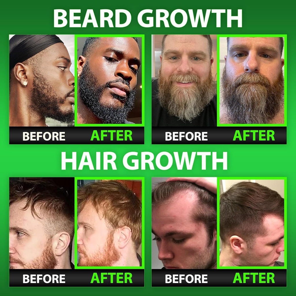 best-beard-stuff-beard-growth-vitamins---2.jpg
