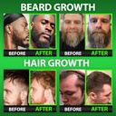 best-beard-stuff-beard-growth-vitamins---2.jpg