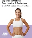 awd-silicone-scar-tape-roll-60in-medical-2.jpg