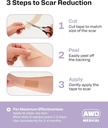 awd-silicone-scar-tape-roll-60in-medical-3.jpg