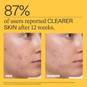 nutrafol-clear-skin-acne-supplement-for--5.jpg