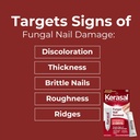 kerasal-nail-fungus-extra-strength-resto-5.jpg