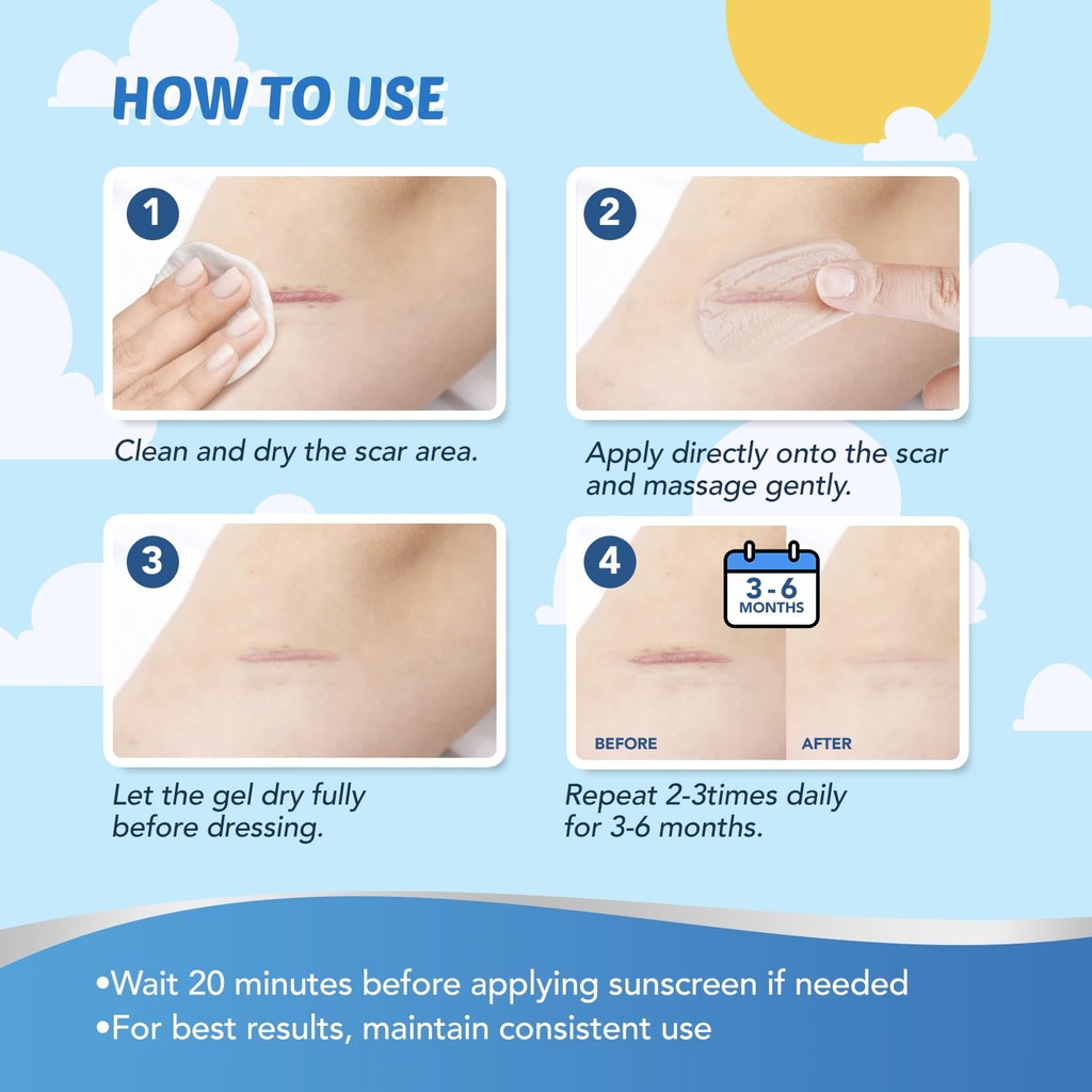kids-silicone-scar-gel-silicone-gel-for--6.jpg