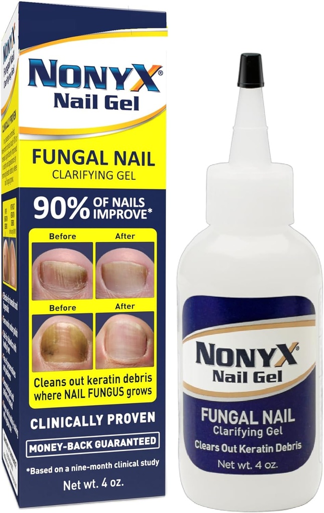 NONYX Fungal Nail Clarifying Gel | Clinically Proven for Discolored, Thick, Brittle, Yellow, Lifted, and other signs of Fungus-Damaged Toenails | 90% of Nails Improve | Over 8 million sold