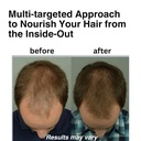 Dr. Steven Gabriel Natural DHT Blocker for Women and Men - Hair Growth Supplement with Saw Palmetto, Stinging Nettle, Pygeum Bark, Pumpkin Seed Oil Capsules (60 Caps)