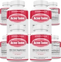 Acne Pills Supplement- Clear Skin Vitamins Pill for Oily Skin Treatment, Hormonal Blemishes, Anti Spots & Cystic Acnes Supplements for Women, Men, Teens & Adults- 240 Oral Tablets