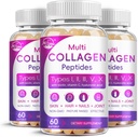 Multi Collagen Peptides Softgel - Type I, II, III, V, X - Hydrolyzed Collagen Peptides with Biotin, Vitamin C, Hyaluronic Acid, Supports Skin Hair Nail, Grass-Fed, Non-GMO, 60 Softgel, 3 Pack